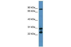 CA2 antibody used at 0. (CA2 Antikörper  (N-Term))