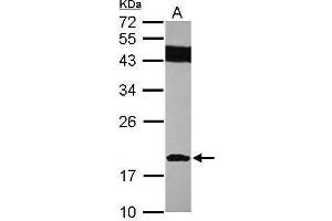 WB Image Sample (30 ug of whole cell lysate) A: IMR32 12% SDS PAGE antibody diluted at 1:1000 (SUMO2 Antikörper)