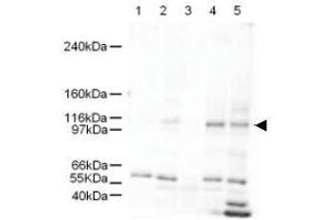 Image no. 1 for anti-SWI/SNF Related, Matrix Associated, Actin Dependent Regulator of Chromatin, Subfamily A-Like 1 (SMARCAL1) (AA 80-96) antibody (ABIN401264) (SMARCAL1 Antikörper  (AA 80-96))
