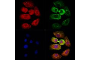 ABIN6264773 and ABIN6278630 staining Hela cells by IF/ICC. (URI1 Antikörper  (Internal Region))