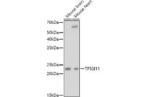 Western blot analysis of extracts of various cell lines, using TP53I11 antibody (ABIN6131365, ABIN6149418, ABIN6149419 and ABIN6216636) at 1:1000 dilution. (TP53I11 Antikörper  (AA 1-70))