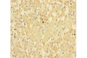 Immunohistochemistry of paraffin-embedded human liver tissue using ABIN7143148 at dilution of 1:100 (SUB1 Antikörper  (AA 2-127))
