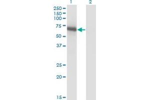 Western Blot analysis of BIN1 expression in transfected 293T cell line by BIN1 monoclonal antibody (M01), clone 1H1. (BIN1 Antikörper  (AA 355-454))