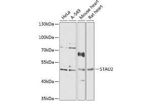 Western blot analysis of extracts of various cell lines, using ST antibody  at 1:1000 dilution. (Double-stranded RNA-binding protein Staufen homolog 2 (STAU2) (AA 300-400) Antikörper)