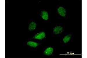 Immunofluorescence of purified MaxPab antibody to HDAC9 on HeLa cell. (HDAC9 Antikörper  (AA 1-1069))