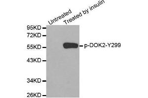 Western blot analysis of extracts from Jurkat cells using Phospho-DOK2-Y299 antibody. (DOK2 Antikörper  (pTyr299))