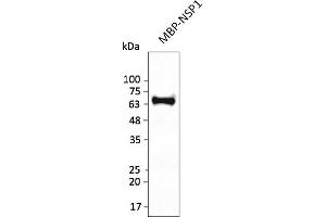 Western Blotting (WB) image for anti-SARS-CoV-2 Host Translation Inhibitor Nsp1 (NSP1) antibody (ABIN7272996) (SARS-CoV-2 NSP1 Antikörper)