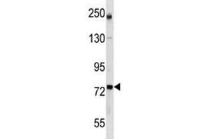 GCLC antibody western blot analysis in mouse bladder tissue lysate (GCLC Antikörper  (AA 286-315))