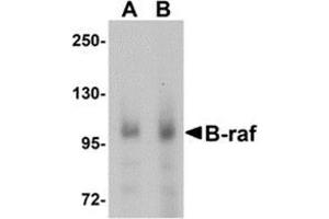 Western blot analysis of B-raf in human brain tissue lysate with B-raf antibody at (A) 1 and (B) 2 μg/ml. (BRAF Antikörper  (Center))
