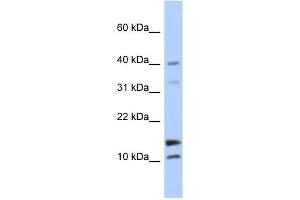 WFDC5 antibody used at 1 ug/ml to detect target protein.