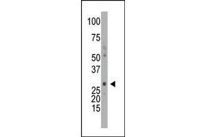 The anti-DCK Pab (ABIN391125 and ABIN2841251) is used in Western blot to detect DCK in mouse intestine tissue lysate. (DCK Antikörper  (C-Term))