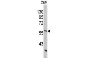 Western blot analysis of KRT10 antibody (Center) in CEM cell line lysates (35ug/lane). (Keratin 10 Antikörper  (Middle Region))