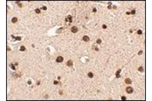 Immunohistochemistry of Rim3 in human brain tissue with this product at 2. (RIMS3 Antikörper  (N-Term))