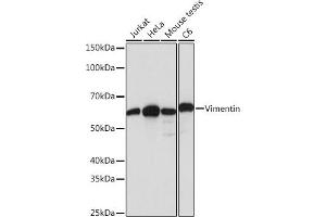 Western blot analysis of extracts of various cell lines, using Vimentin antibody (ABIN7271326) at 1:1000 dilution.