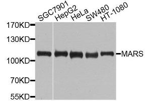 Western blot analysis of extracts of various cell lines, using MARS antibody (ABIN6003646) at 1/1000 dilution. (Mars (MARS) Antikörper)
