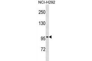 Western Blotting (WB) image for anti-Zinc Finger Protein 229 (ZNF229) antibody (ABIN3000622) (ZNF229 Antikörper)