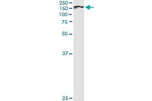 BUB1 (Human) IP-WB Antibody Pair