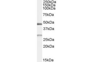 Western Blotting (WB) image for anti-BCL2/adenovirus E1B 19kDa Interacting Protein 1 (BNIP1) (AA 162-176) antibody (ABIN295942) (BNIP1 Antikörper  (AA 162-176))