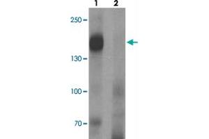 Western blot analysis of LNPEP in human lung tissue with LNPEP polyclonal antibody  at 1 ug/mL in (1) the absence and (2) the presence of blocking peptide. (LNPEP Antikörper  (C-Term))