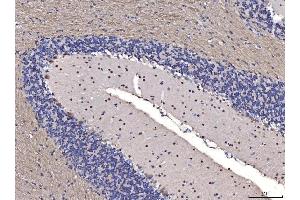 IHC analysis of FGF2 using anti-FGF2 antibody (ABIN7603215). (FGF2 Antikörper  (N-Term))