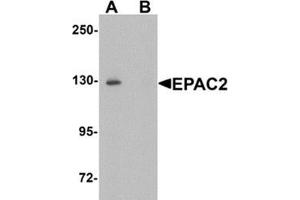 Western blot analysis of EPAC2 in rat liver tissue lysate with EPAC2 Antibody at 1 μg/ml in (A) the absence and (B) the presence of blocking peptide. (RAPGEF4 Antikörper  (N-Term))