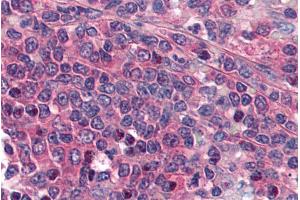ABIN185589 (5µg/ml) staining of paraffin embedded Human Spleen. (PTGER1 Antikörper  (Internal Region))