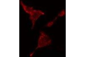 ABIN6278562 staining  HeLa cells by IF/ICC. (CTBP2 Antikörper  (C-Term))