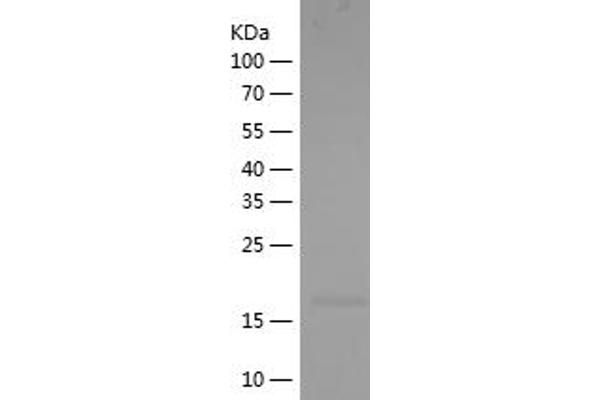 IL1F9 Protein (AA 18-169) (His tag)