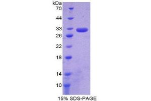 SDS-PAGE (SDS) image for Complement Component 6 (C6) (AA 682-934) protein (His tag) (ABIN1878564)