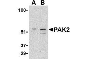 Western Blotting (WB) image for anti-P21-Activated Kinase 2 (PAK2) (C-Term) antibody (ABIN1030567) (PAK2 Antikörper  (C-Term))