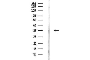 anti-Thiopurine S-Methyltransferase (TPMT) (N-Term) antibody