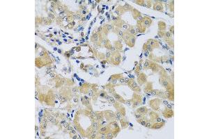Immunohistochemistry of paraffin-embedded human stomach using SYT11 antibody at dilution of 1:100 (x40 lens).