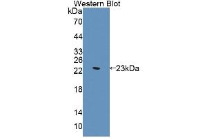 Western blot analysis of the recombinant protein. (Supervillin Antikörper  (AA 1385-1525))