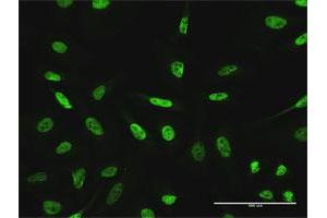 Immunofluorescence of purified MaxPab antibody to GTF3C2 on HeLa cell. (GTF3C2 Antikörper  (AA 1-911))