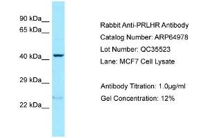 Western Blotting (WB) image for anti-Prolactin Releasing Hormone Receptor (PRLHR) (N-Term) antibody (ABIN2774413) (PRLHR Antikörper  (N-Term))