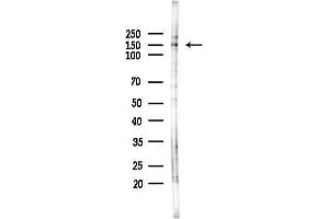 anti-Patatin-Like phospholipase Domain Containing 6 (PNPLA6) (Internal Region) antibody