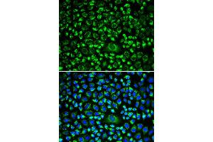 Immunofluorescence (IF) image for anti-TAP Binding Protein (Tapasin) (TAPBP) antibody (ABIN1875423) (TAPBP Antikörper)