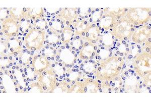 Detection of PAI1 in Human Kidney Tissue using Monoclonal Antibody to Plasminogen Activator Inhibitor 1 (PAI1) (PAI1 Antikörper)