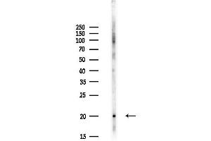 Western blot analysis of lysates from Hela cells(UV,30 min treatment), using FAM162B Antibody at 1/1000 dilution. (FAM162B Antikörper)
