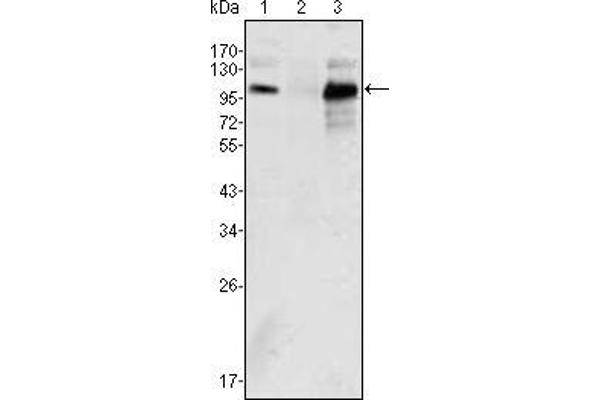 Androgen Receptor Antikörper