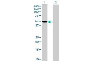 Lane 1: LAG3 transfected lysate ( 39. (LAG3 293T Cell Transient Overexpression Lysate(Denatured))