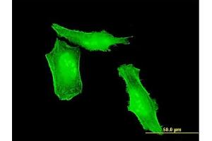 Immunofluorescence of monoclonal antibody to HRSP12 on HeLa cell. (HRSP12 Antikörper  (AA 1-137))