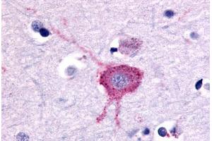 Anti-GRM2 / MGLUR2 antibody  ABIN1048928 IHC staining of human brain, neurons and glia. (GRM2 Antikörper  (N-Term))