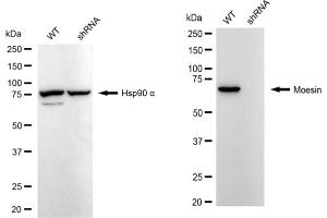 Western blotting analysis using Moesin antibody (ABIN7799482).