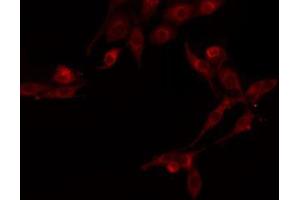 Immunofluorescence (fixed cells) (IF/ICC) image for anti-Histone Deacetylase 5 (HDAC5) (C-Term) antibody (ABIN6262182)