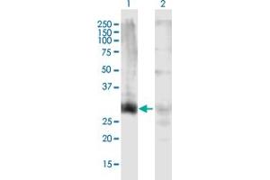 Western Blot analysis of HOXD13 expression in transfected 293T cell line by HOXD13 MaxPab polyclonal antibody. (Homeobox D13 Antikörper  (AA 1-343))