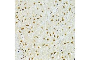 Immunohistochemistry (Paraffin-embedded Sections) (IHC (p)) image for anti-Adenosine Deaminase, RNA-Specific (ADAR) (AA 150-250) antibody (ABIN6136553)