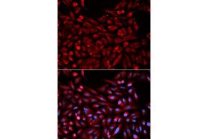 Immunofluorescence analysis of U2OS cells using NR1I3 antibody. (NR1I3 Antikörper  (AA 103-352))