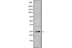 Western blot analysis of EBI3 using COLO205 whole cell lysates (EBI3 Antikörper  (N-Term))