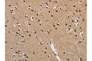 The image is immunohistochemistry of paraffin-embedded Human brain tissue using ABIN7128907(CENPN Antibody) at dilution 1/70. (CENPN Antikörper)